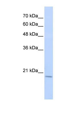RBM39 Antibody (aa91-140)