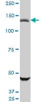 USP45 Antibody (clone 1H2)