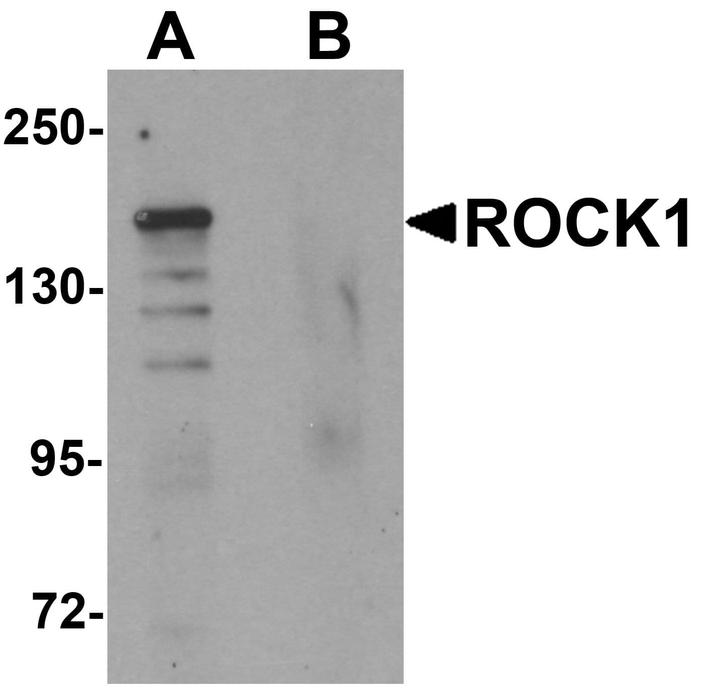 IHC-plus™ Rho Kinase / ROCK1 Antibody