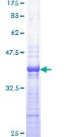 Human PRKAR1A Protein (Recombinant GST, N-terminus)