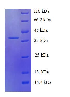 Human CCL19 / MIP3-Beta Protein (Recombinant GST)