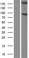 NPHP1 / Nephronophthisis Protein (Over-Expression Lysate Myc-DDK (Flag))