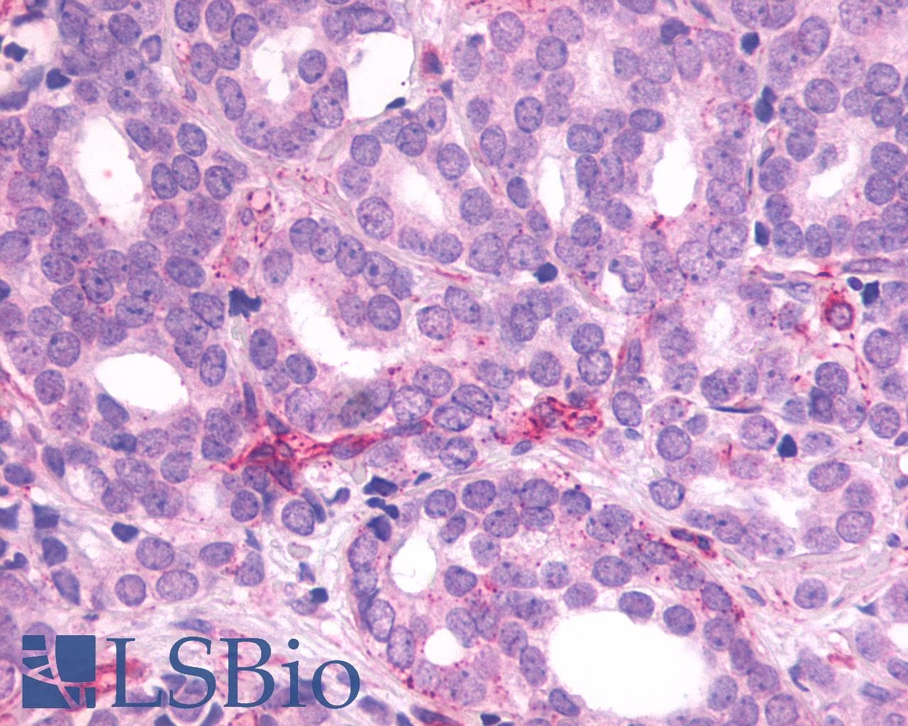 PathPlus™ Polyclonal Rabbit anti-Human SSTR1 Antibody (C-Terminus, IHC)