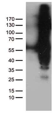 IKBKG / NEMO / IKK Gamma Antibody (clone OTI2F2, Carrier-free)
