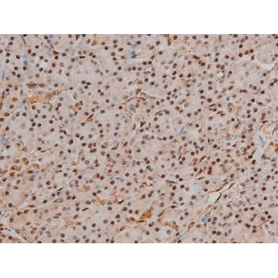 Polyclonal Rabbit anti-Human FLNA / Filamin A Antibody (phospho-Ser2152, IHC, IF, WB)