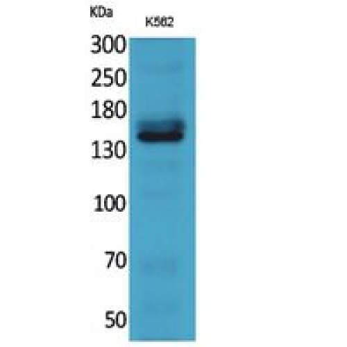RFC1 / RFC Antibody (1071-1120 aa, C-terminal)