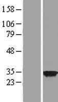 COPS7B / CSN7B Protein (Over-Expression Lysate Myc-DDK (Flag))