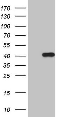 CDCA8 / Borealin Antibody (clone OTI7G7)