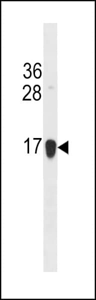 Polyclonal Rabbit anti-Human HIST1H2BJ Antibody (aa98-126, WB)