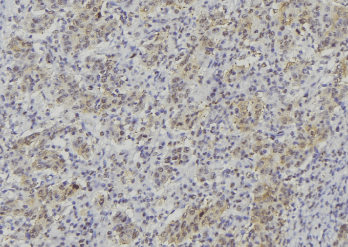 Polyclonal Rabbit anti-Human TPSAB1 / Mast Cell Tryptase Antibody (IHC, IF, WB)