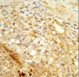 CDC73 / Parafibromin Antibody (aa132-161)