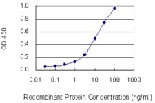 RD / PHYH Antibody (clone 1F2-5B9)