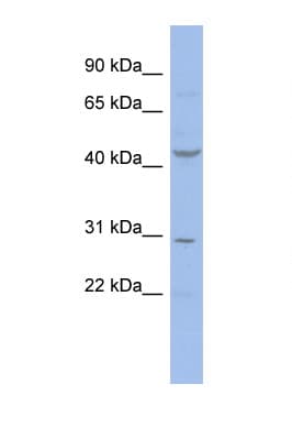 CCNE2 / Cyclin E2 Antibody (aa35-84)