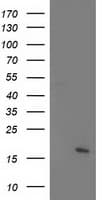 C21orf34 Antibody (clone OTI5D1)
