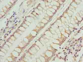 Polyclonal Rabbit anti-Human RFESD Antibody (IHC)