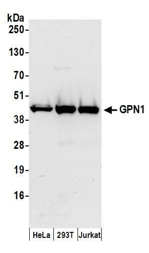 GPN1 / XAB1 Antibody (aa324-374)