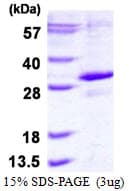 Human EGLN3 / PHD3 Protein (Recombinant His)