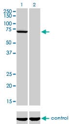 Monoclonal Mouse anti-Human MPP3 Antibody (clone 4D7, WB)