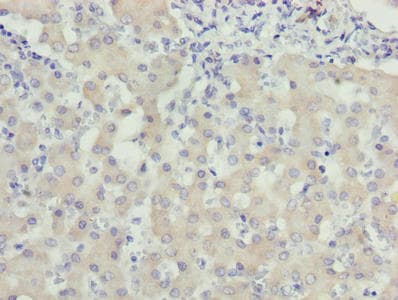 Polyclonal Rabbit anti-Human WDR91 Antibody (IHC)