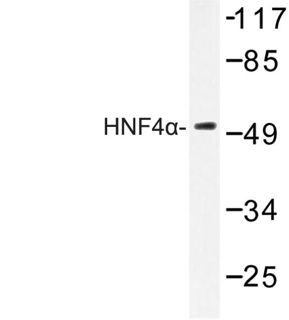 HNF4A / HNF4 Antibody (Lys298)