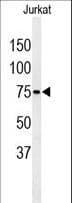 Polyclonal Rabbit anti-Human PAN3 Antibody (aa771-799, IHC, WB)