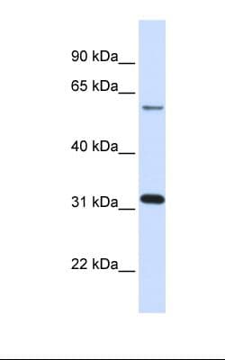 PathPlus™ LGALS3 / Galectin 3 Antibody (aa38-87)