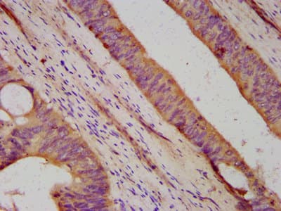 DHX34 Antibody