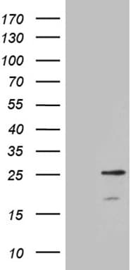 CIB3 Antibody (clone OTI5F12)