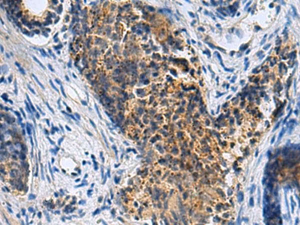 Polyclonal Rabbit anti-Human PLIN4 / S3-12 Antibody (IHC)