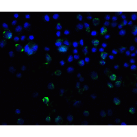 SQSTM1 Antibody