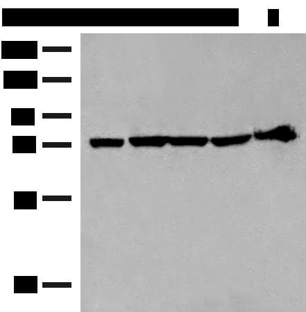 CALCOCO1 / CoCoa Antibody
