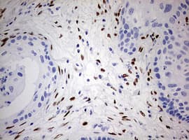 ZEB1 / AREB6 Antibody (aa1-350, clone OTI3G6)
