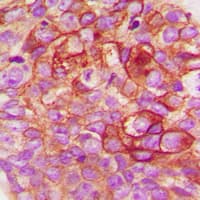 Polyclonal Rabbit anti-Human SRC Antibody (C-Terminus, IHC, IF, WB)