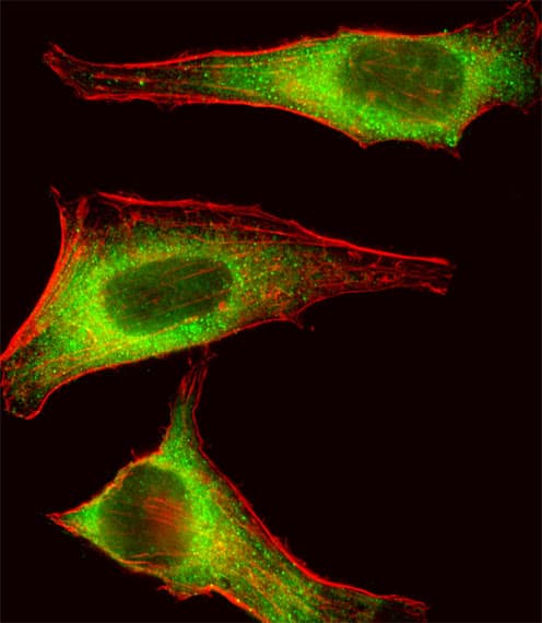TEC Antibody (aa175-205)