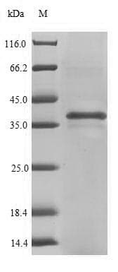 Mouse TECTB Protein (Recombinant 6His, N-terminus)