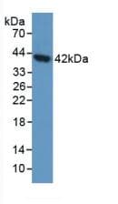AGA / Aspartylglucosaminidase Antibody (aa28-245)