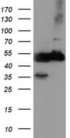 TUBAL3 Antibody (aa150-446, clone OTI5F10, Carrier-free)