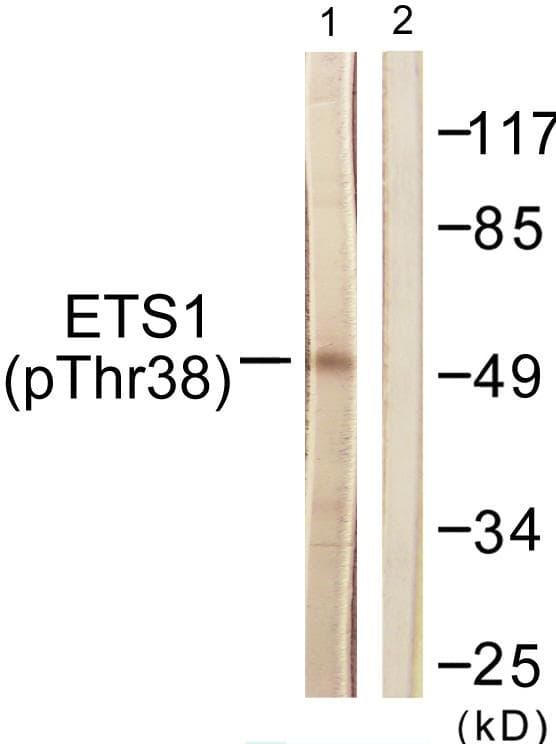 ETS1 / ETS-1 Antibody (phospho-Thr38)