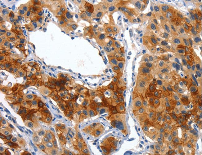 PLAP / Alkaline Phosphatase Antibody