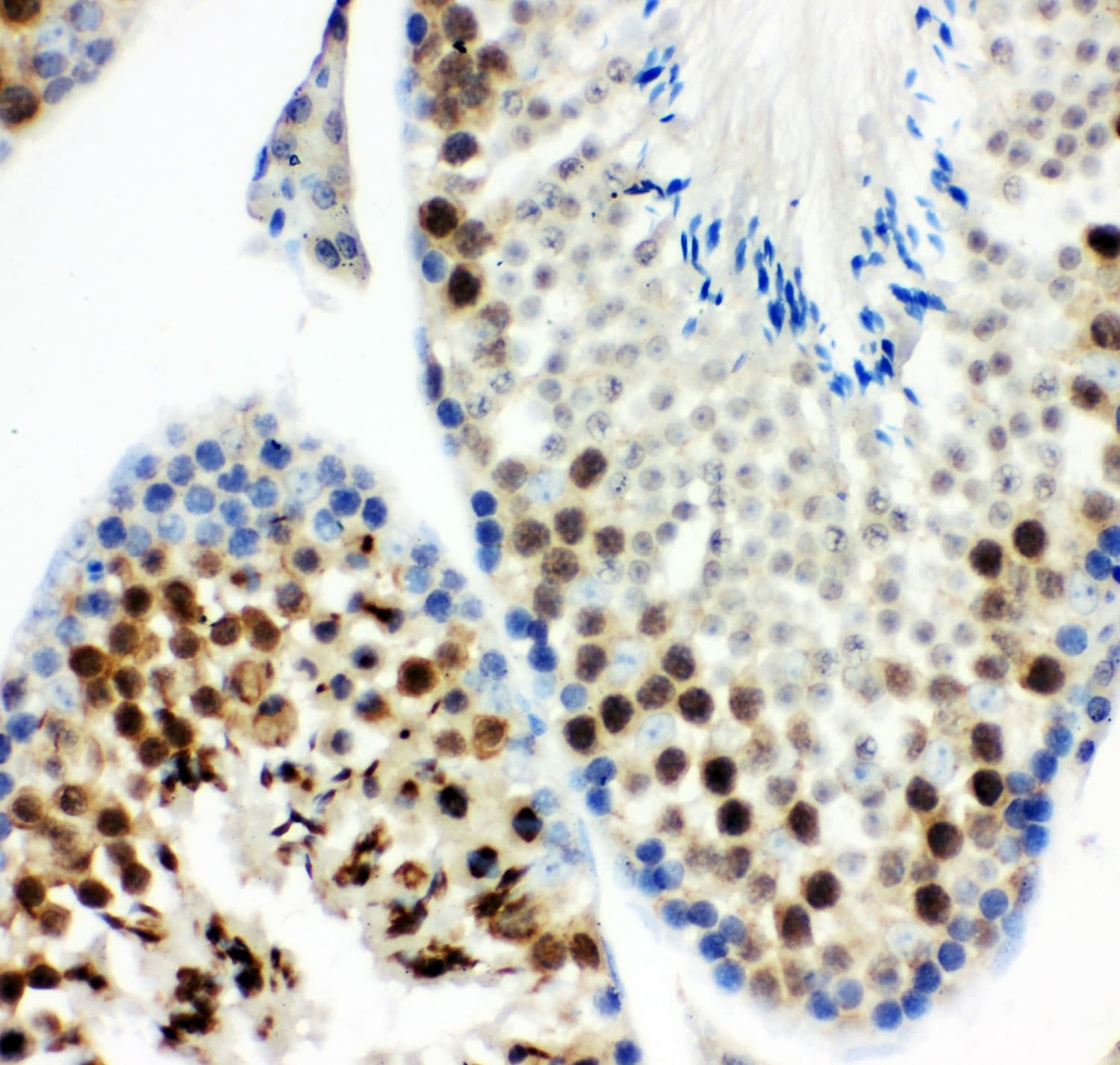 KIF2C / MCAK Antibody (aa531-725)