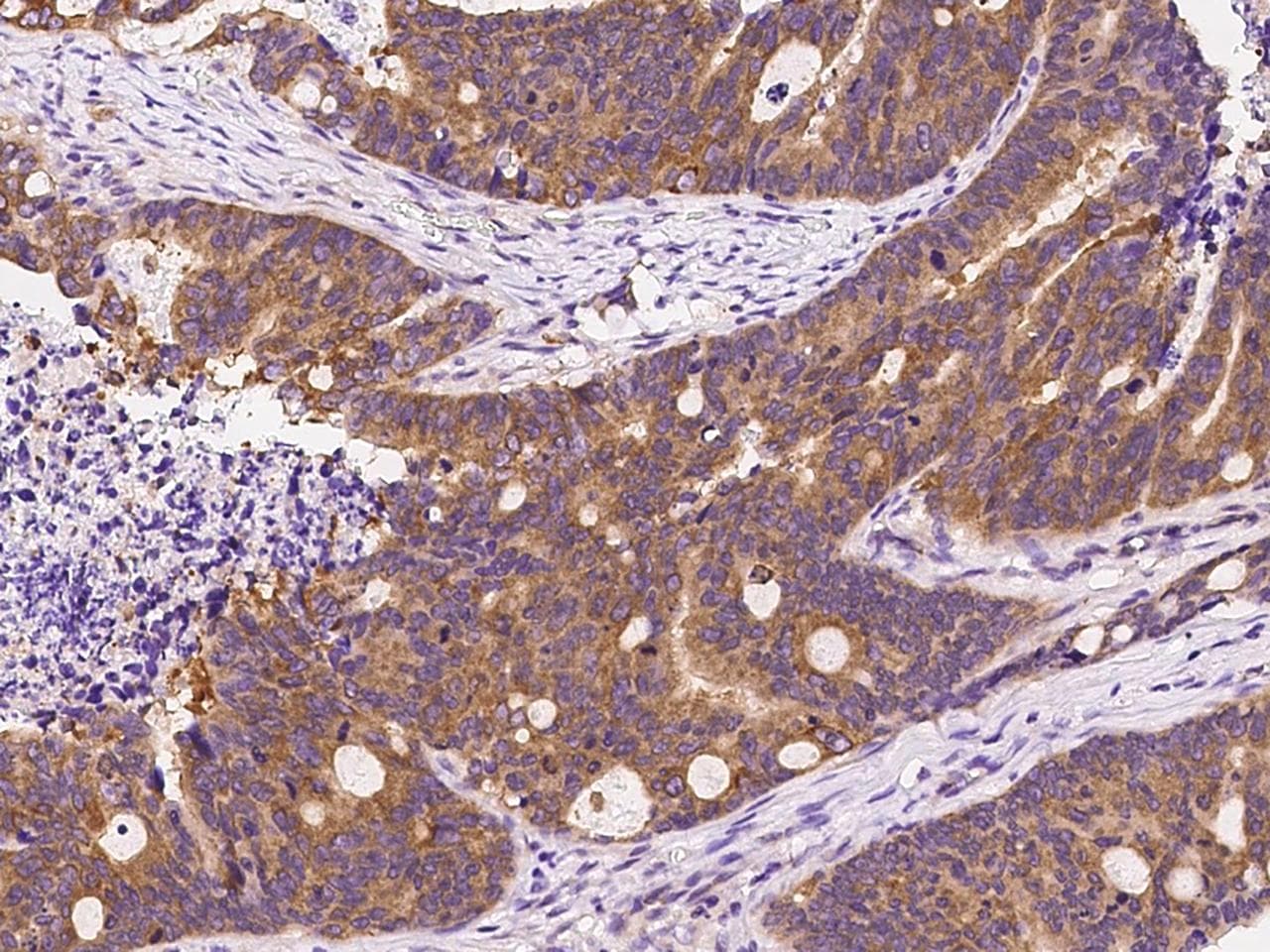 Polyclonal Rabbit anti-Human ARF3 Antibody (IHC)