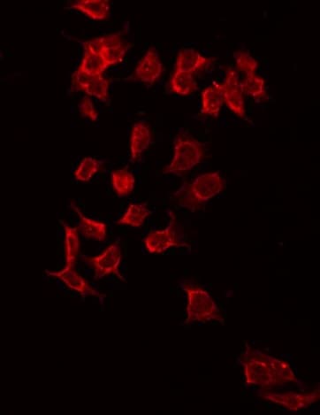 Polyclonal Rabbit anti-Human KCNJ3 / GIRK1 Antibody (IHC, IF, WB)