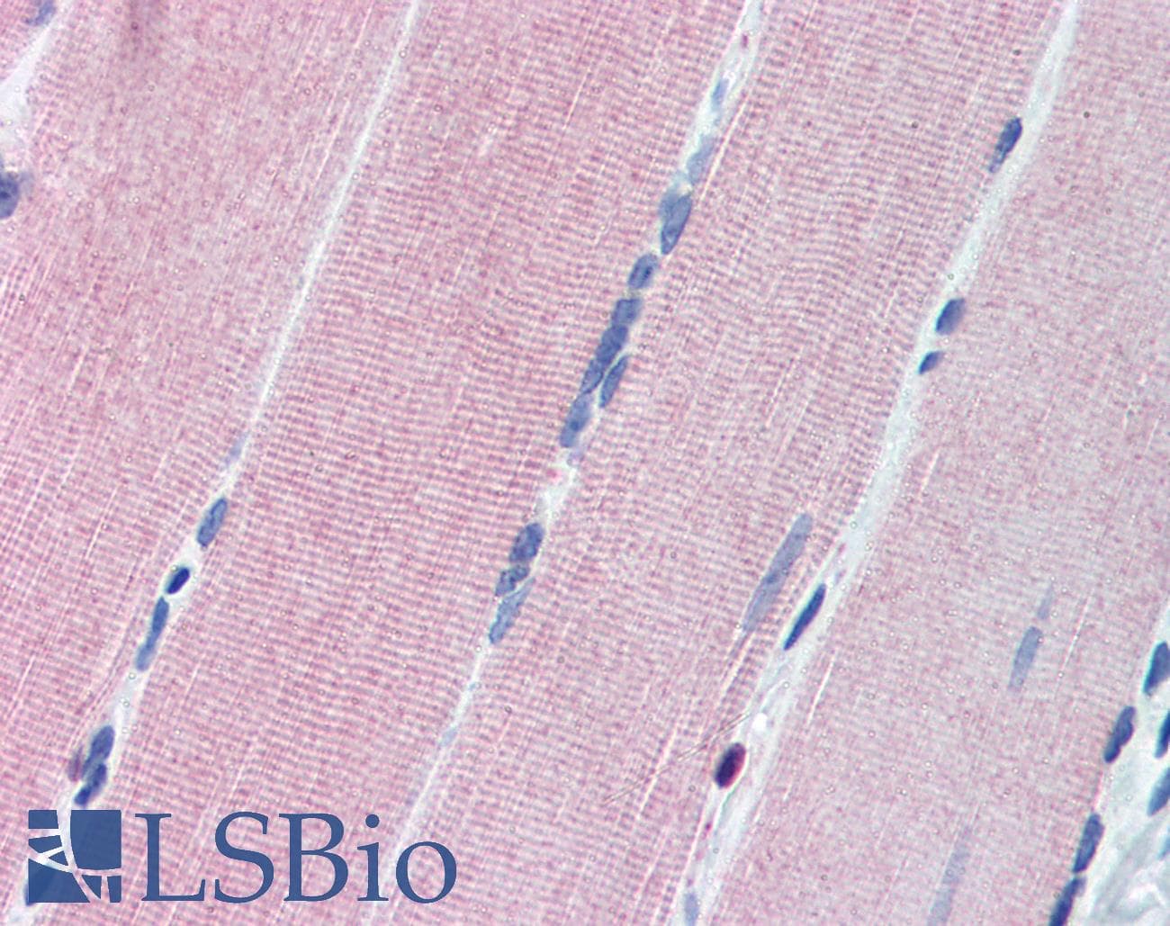 IHC-plus™ Polyclonal Rabbit anti-Human PKG / PRKG1 Antibody (aa657-671, IHC, WB)