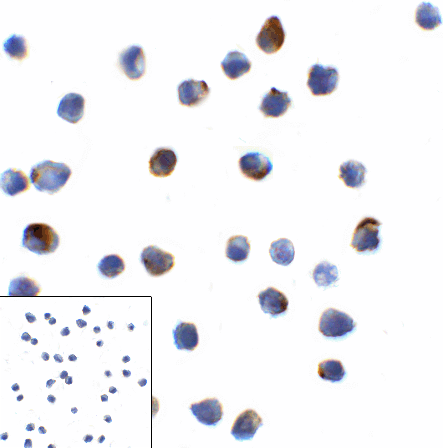 Monoclonal Mouse anti-Human LAG3 Antibody (clone 5F11, IHC, IF, WB)
