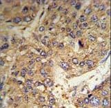 FGG / Fibrinogen Gamma Antibody (aa417-445)