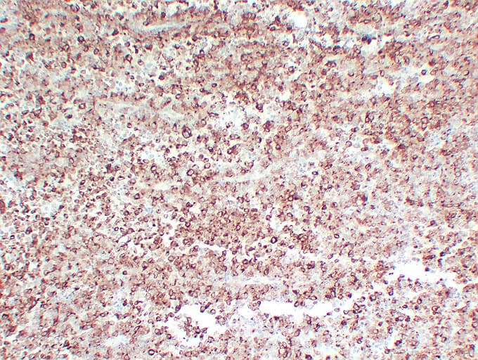 PMEL / SILV / gp100 Antibody (clone ABT-PMEL)