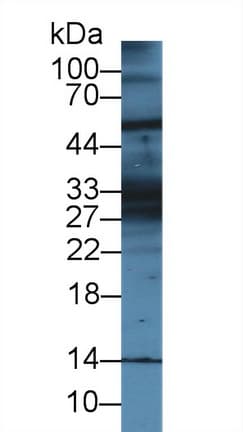 KRT28 / Keratin 28 Antibody (aa1-462)