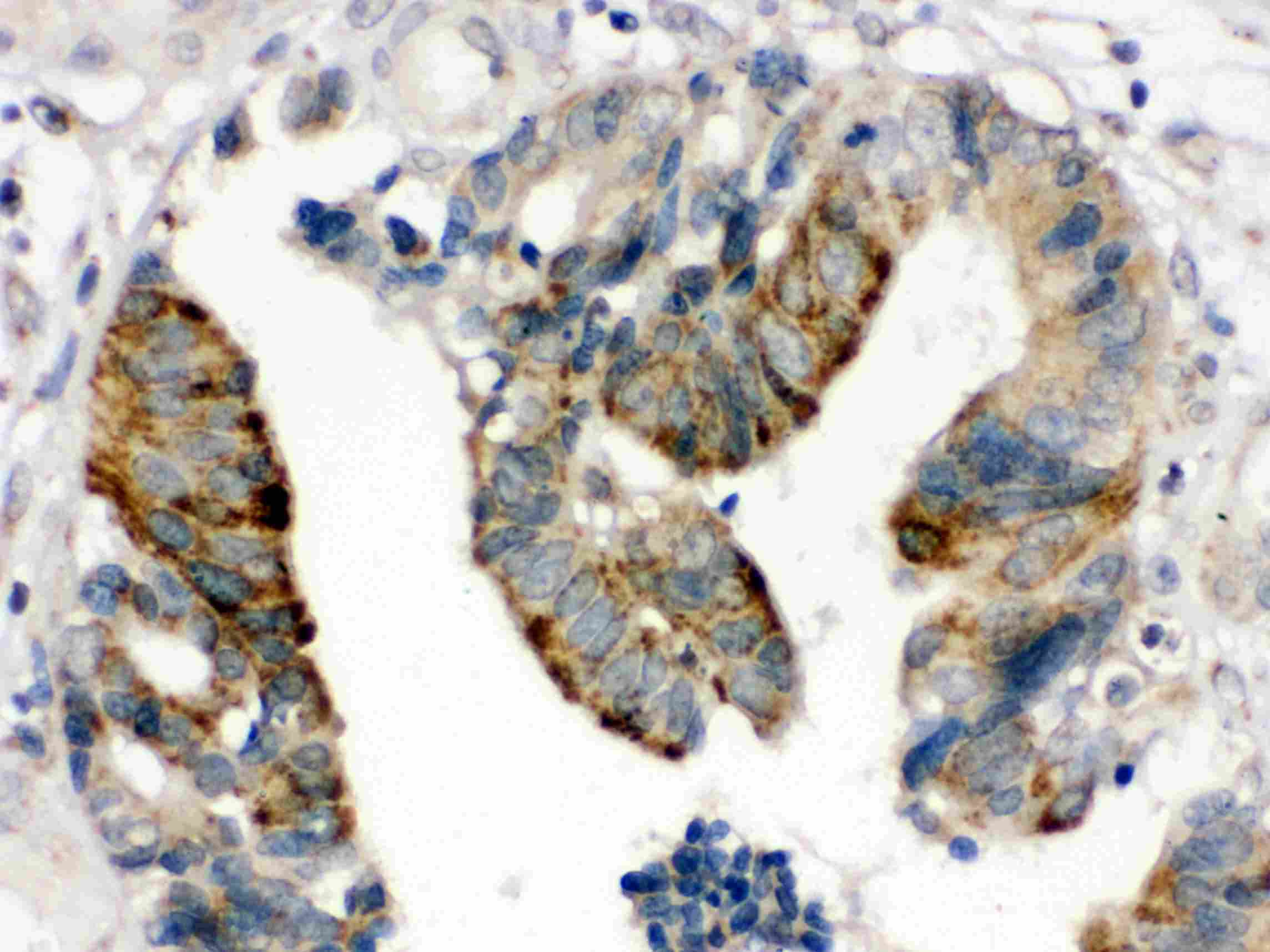 HMG2 / HMGB2 Antibody