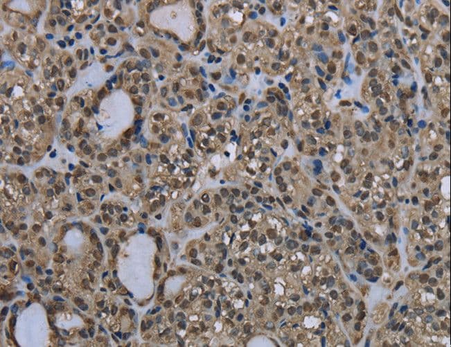 Polyclonal Rabbit anti-Human UBB / Ubiquitin B Antibody (IHC, WB)