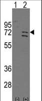 PARP6 Antibody (aa553-583)